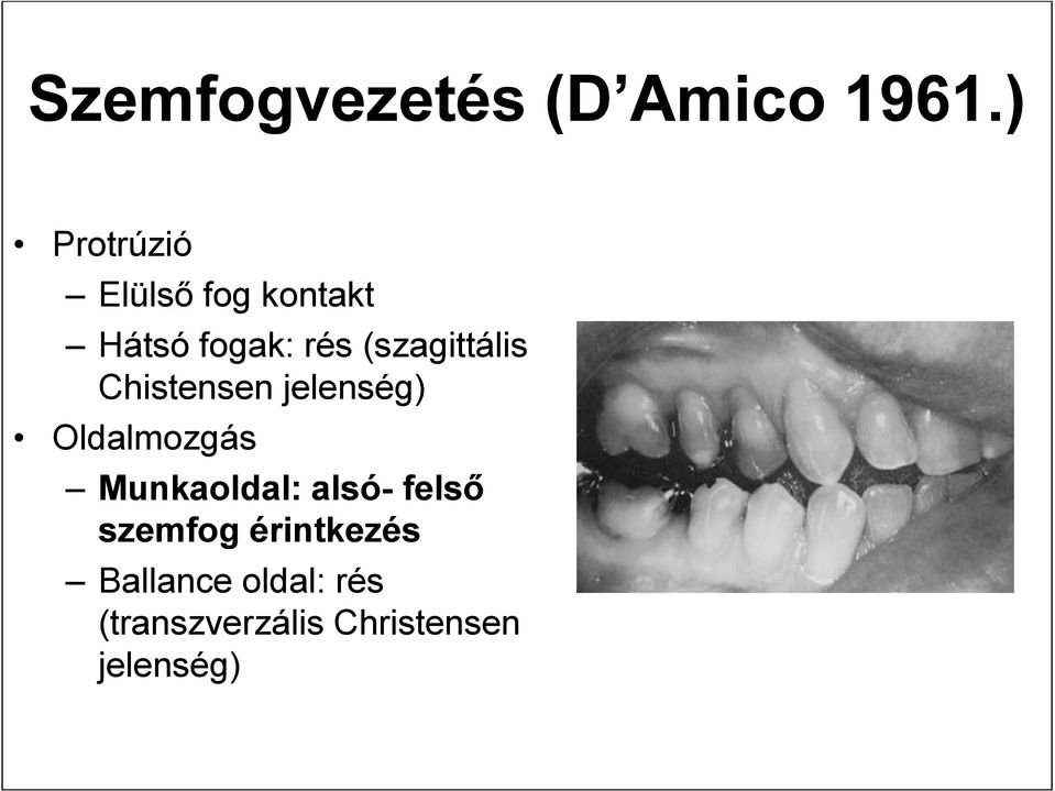 (szagittális Chistensen jelenség) Oldalmozgás