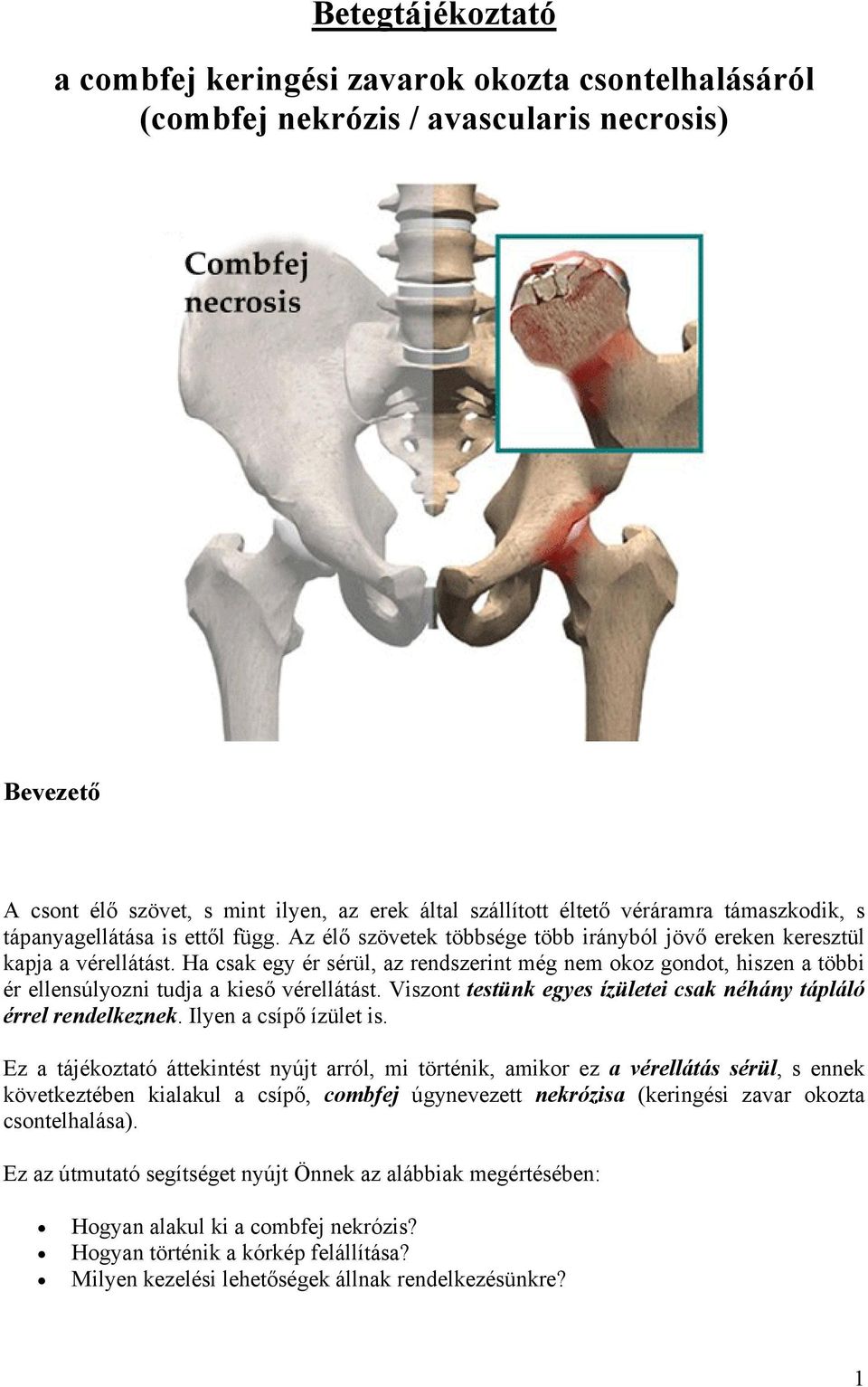 áttekintés a csípőízület artrózisának kezeléséről)