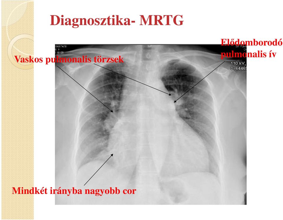 törzsek Mindkét irányba