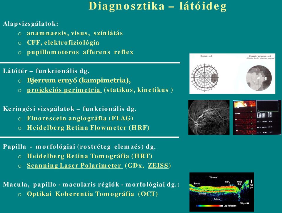 o Fluorescein angiográfia (FLAG) o Heidelberg Retina Flowmeter (HRF) Papilla - morfológiai (rostréteg elemzés) dg.