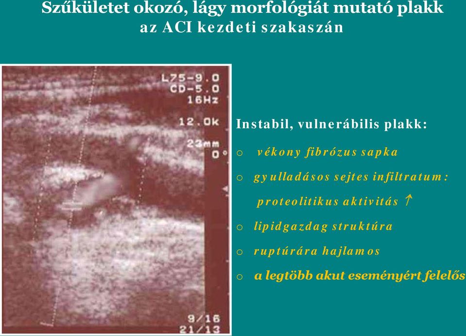 gyulladásos sejtes infiltratum: proteolitikus aktivitás o o o