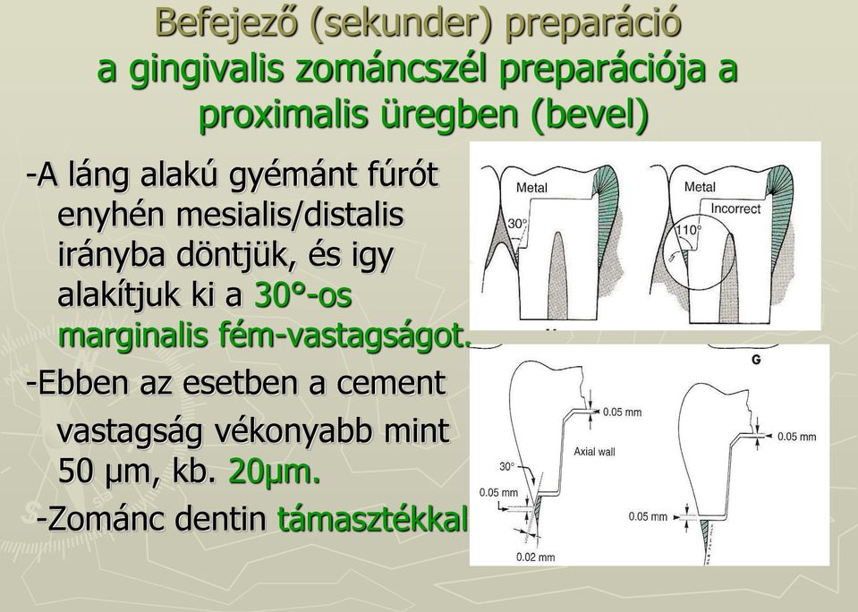 irányba döntjük, és igy alakítjuk ki a 30 -os marginalis fém-vastagságot.