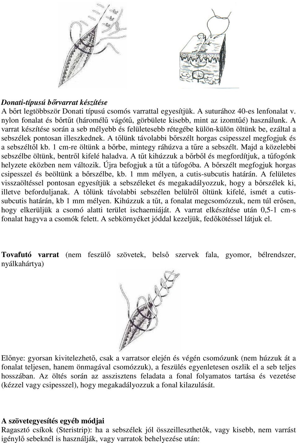 A varrat készítése során a seb mélyebb és felületesebb rétegébe külön-külön öltünk be, ezáltal a sebszélek pontosan illeszkednek.