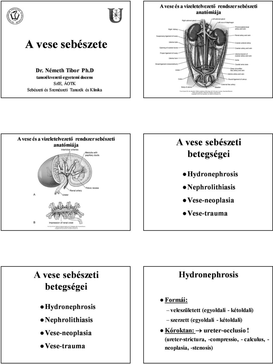 rendszer sebészeti anatómiája A vese sebészeti betegségei A vese sebészeti betegségei Formái: veleszületett