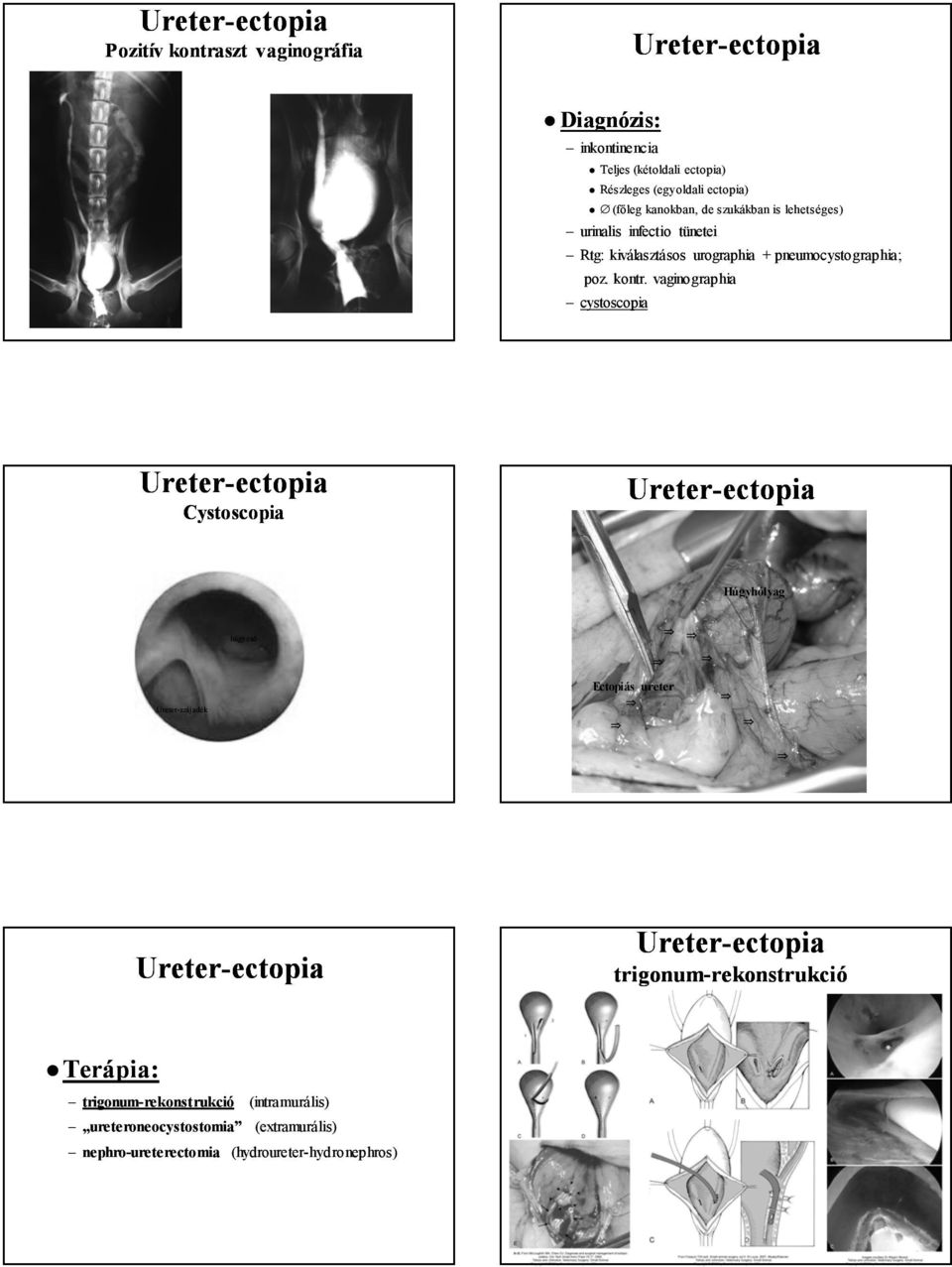 vaginographia cystoscopia Ureter- Cystoscopia Ureter- Húgyhólyag húgycső Ureter-szájadék Ectopiás ureter Ureter- Ureter-