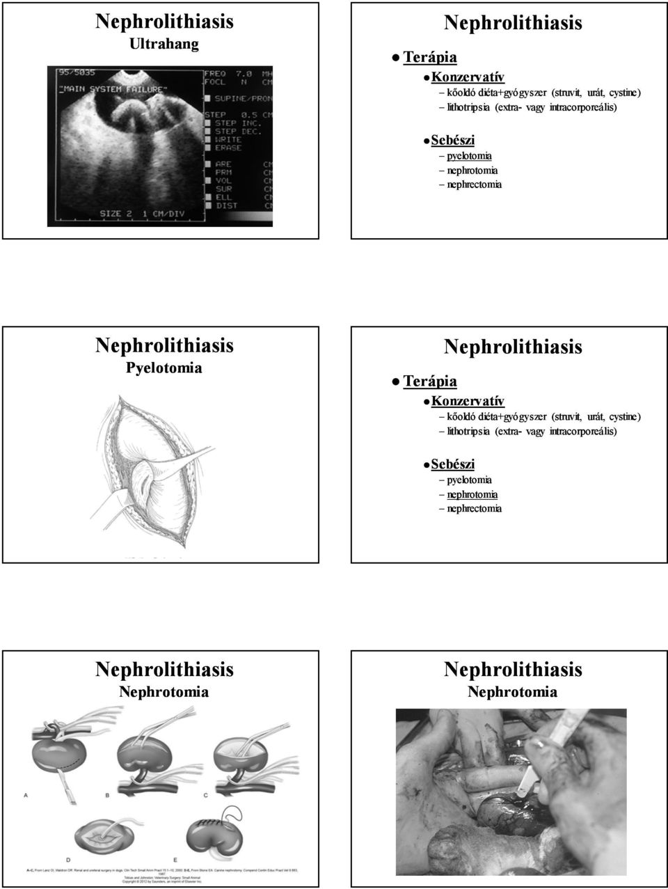 Pyelotomia Terápia Konzervatív kőoldó diéta+gyógyszer (struvit struvit, urát, cystine) 