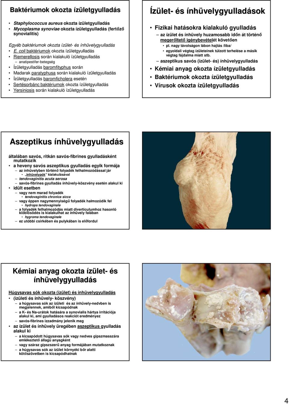 Ízületgyulladás baromficholera esetén Sertésorbánc baktériumok okozta ízületgyulladás Yersiniosis során kialakuló ízületgyulladás Ízület- és ínhüvelygyulladások Fizikai hatásokra kialakuló gyulladás
