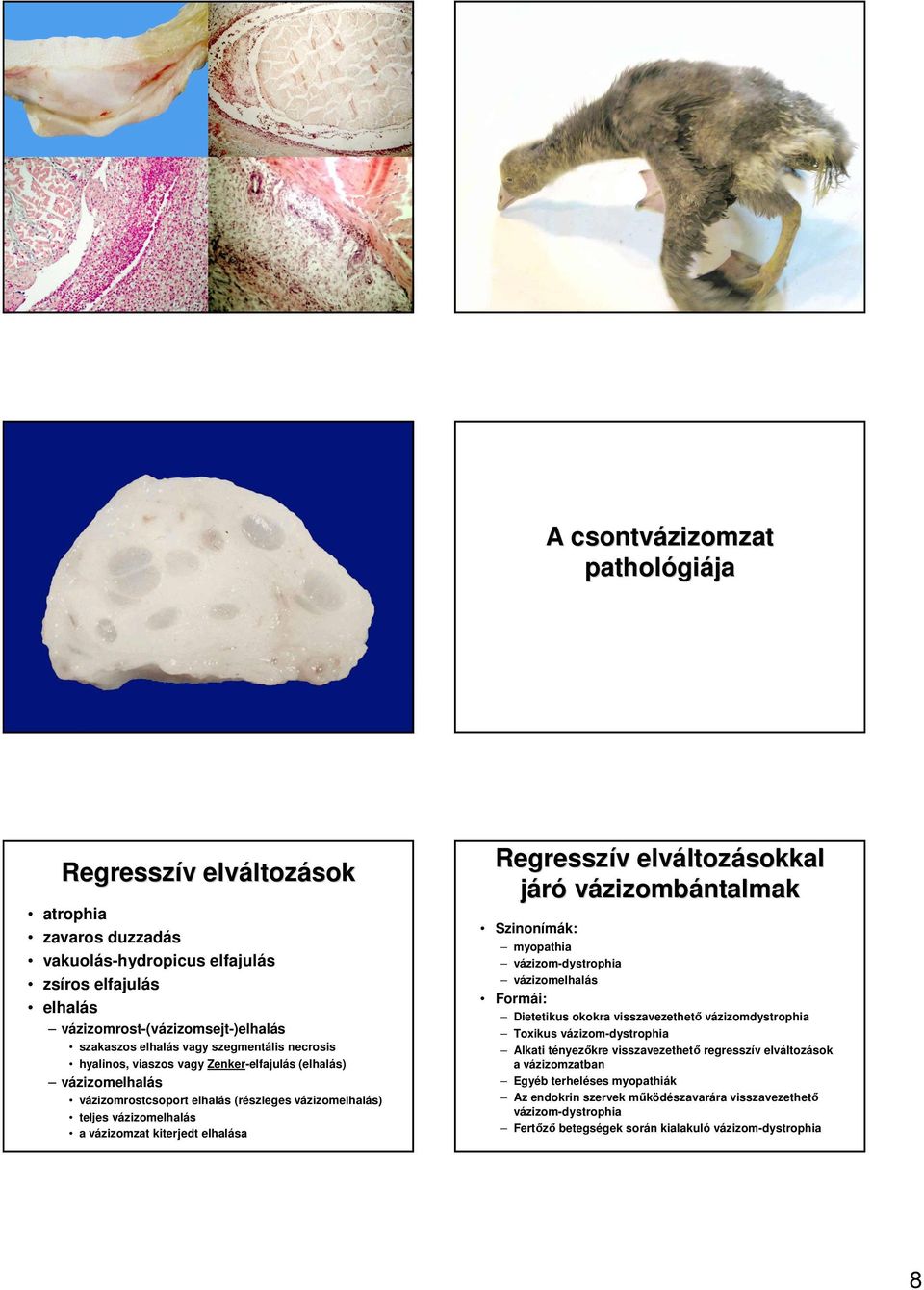 Regresszív v elváltoz ltozásokkal járó vázizombántalmak Szinonímák: myopathia vázizom-dystrophia vázizomelhalás Formái: Dietetikus okokra visszavezethetı vázizomdystrophia Toxikus vázizom-dystrophia
