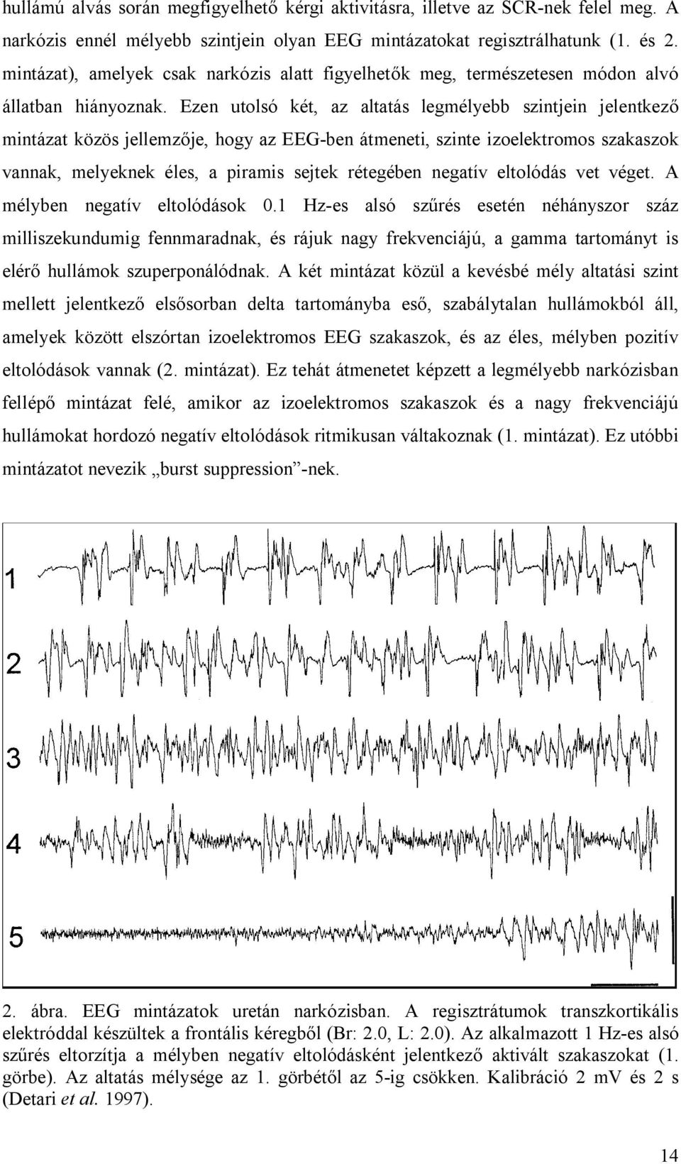 Ezen utolsó két, az altatás legmélyebb szintjein jelentkező mintázat közös jellemzője, hogy az EEG-ben átmeneti, szinte izoelektromos szakaszok vannak, melyeknek éles, a piramis sejtek rétegében