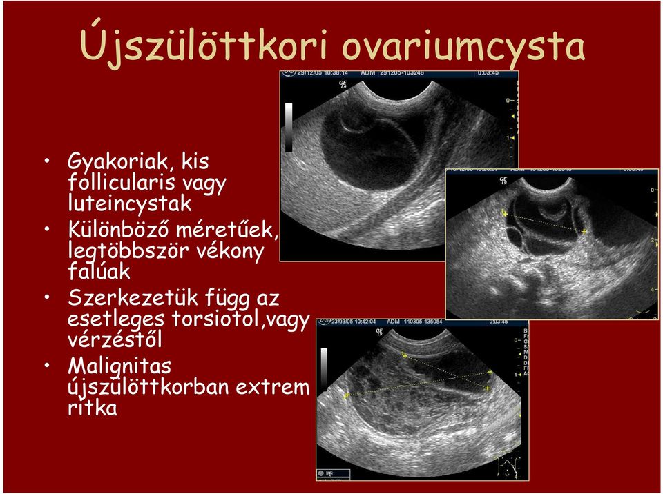 legtöbbször vékony falúak Szerkezetük függ az