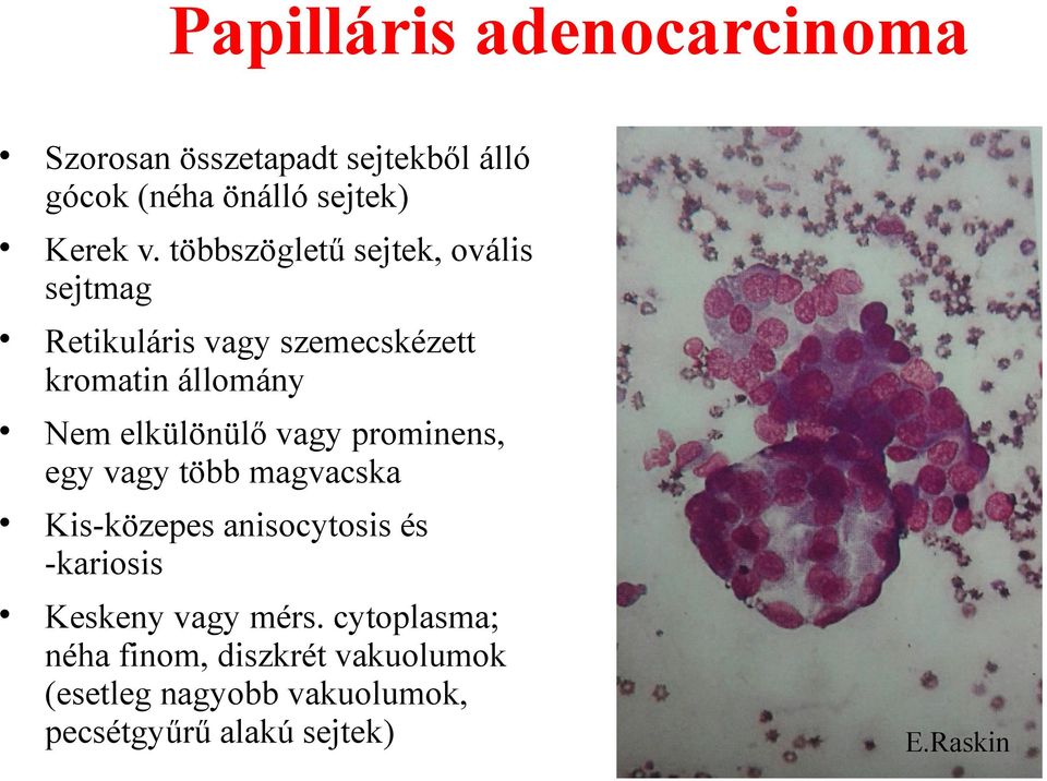 vagy prominens, egy vagy több magvacska Kis-közepes anisocytosis és -kariosis Keskeny vagy mérs.