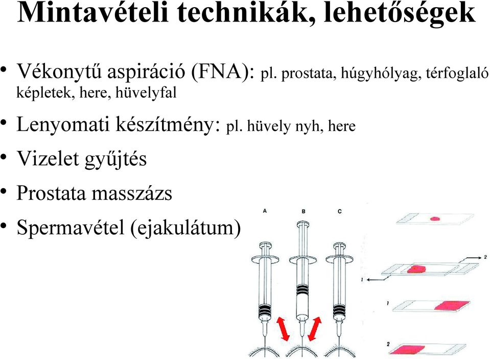 prostata, húgyhólyag, térfoglaló képletek, here,