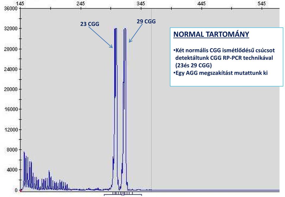 detektáltunk CGG RP-PCR technikával (23és