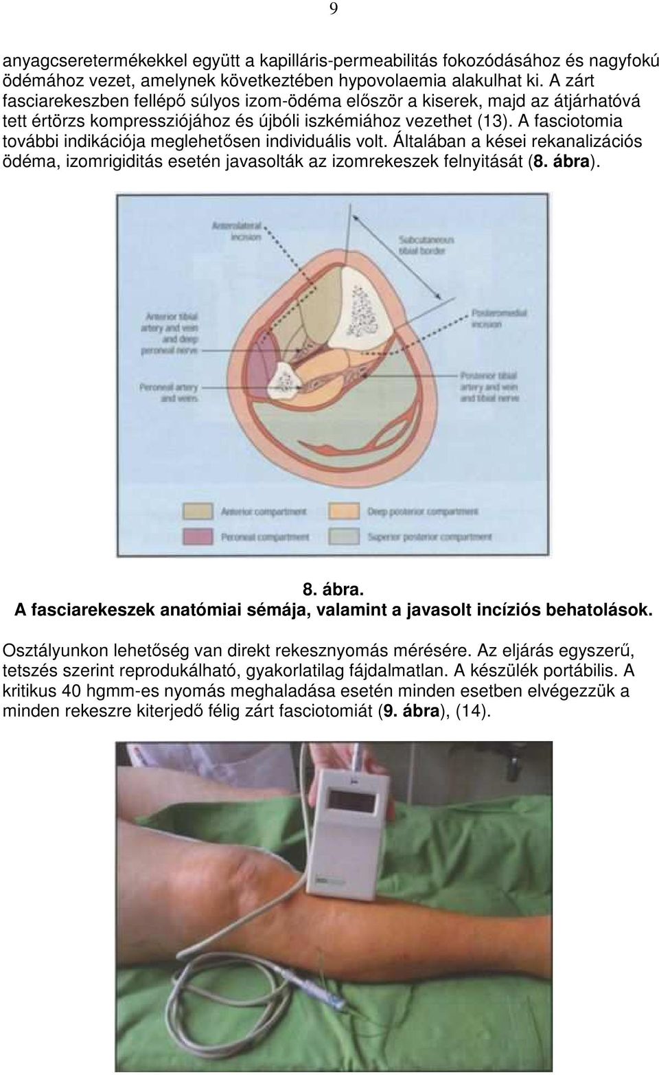 A fasciotomia további indikációja meglehetısen individuális volt. Általában a kései rekanalizációs ödéma, izomrigiditás esetén javasolták az izomrekeszek felnyitását (8. ábra)