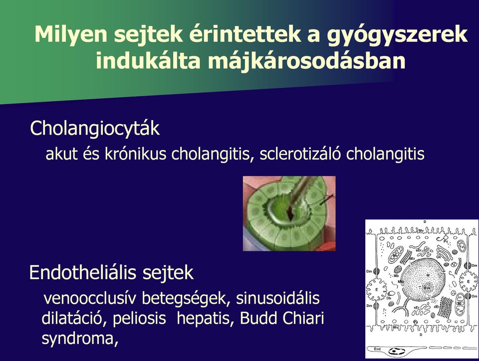 sclerotizáló cholangitis Endotheliális sejtek venoocclusív