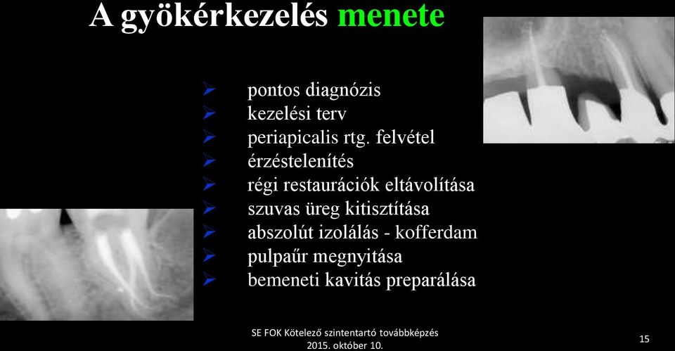 felvétel érzéstelenítés régi restaurációk eltávolítása