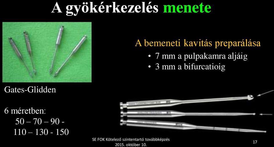 a pulpakamra aljáig 3 mm a