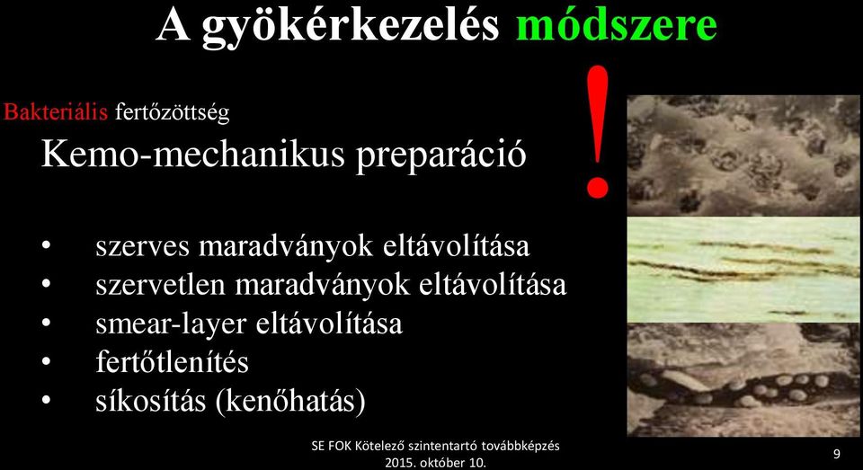eltávolítása szervetlen maradványok eltávolítása