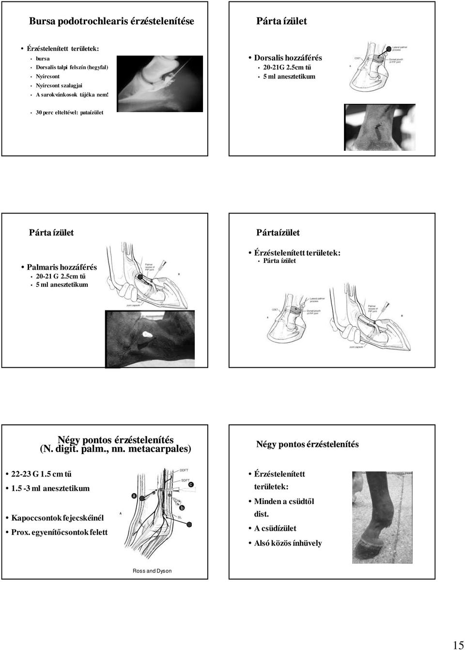 5cm tő 5 ml anesztetikum Pártaízület Érzéstelenített területek: Párta ízület Négy pontos érzéstelenítés (N. digit. palm., nn. metacarpales) 22-23 G 1.5 cm tő 1.