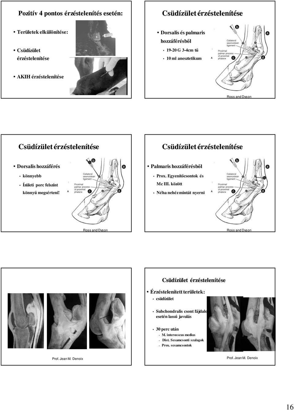 Palmaris hozzáférésbıl Prox. Egyenítıcsontok és Mc III.