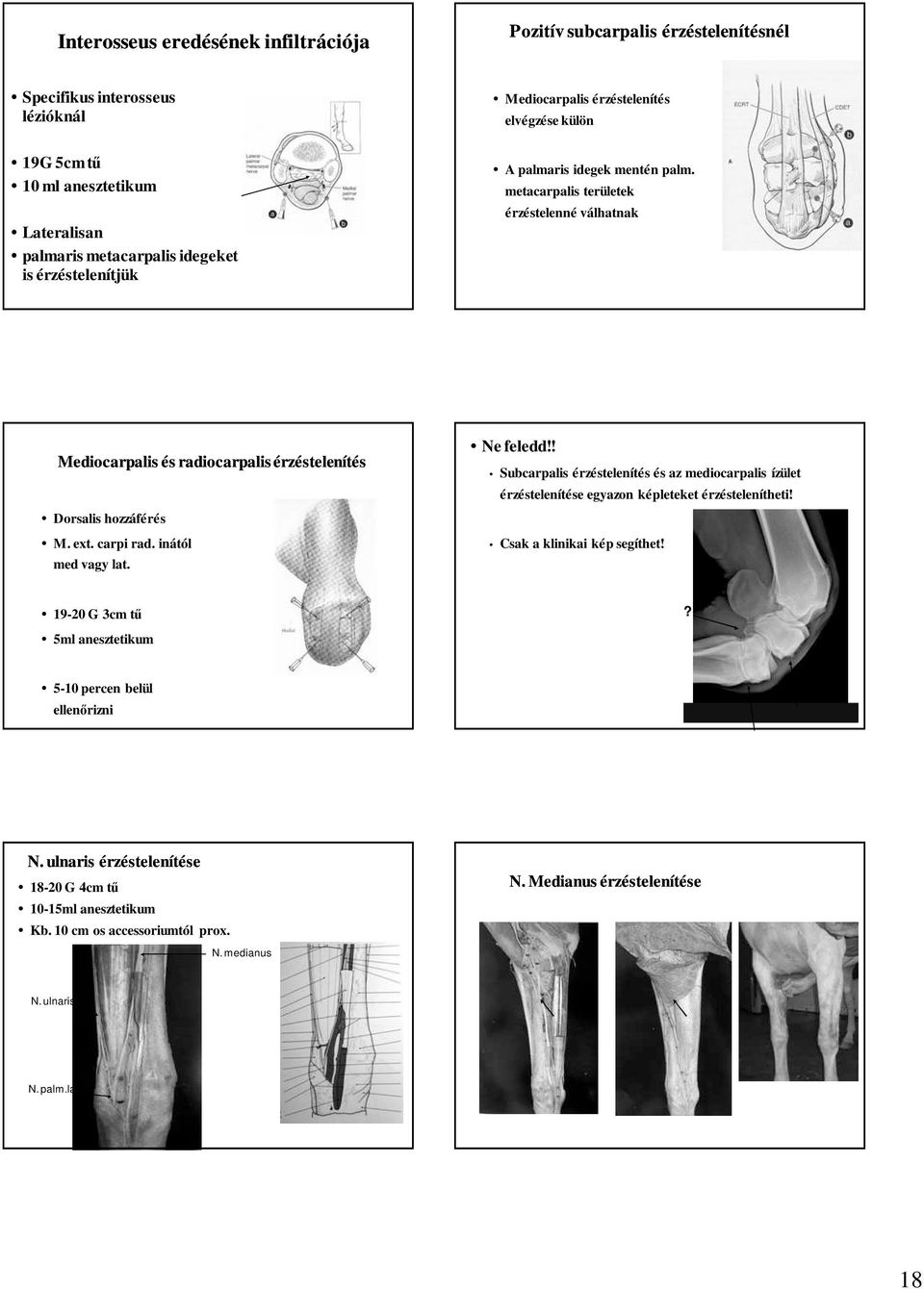 carpi rad. inától med vagy lat. Ne feledd!! Subcarpalis érzéstelenítés és az mediocarpalis ízület érzéstelenítése egyazon képleteket érzéstelenítheti! Csak a klinikai kép segíthet!