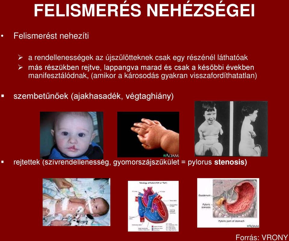 későbbi években manifesztálódnak, (amikor a károsodás gyakran visszafordíthatatlan)