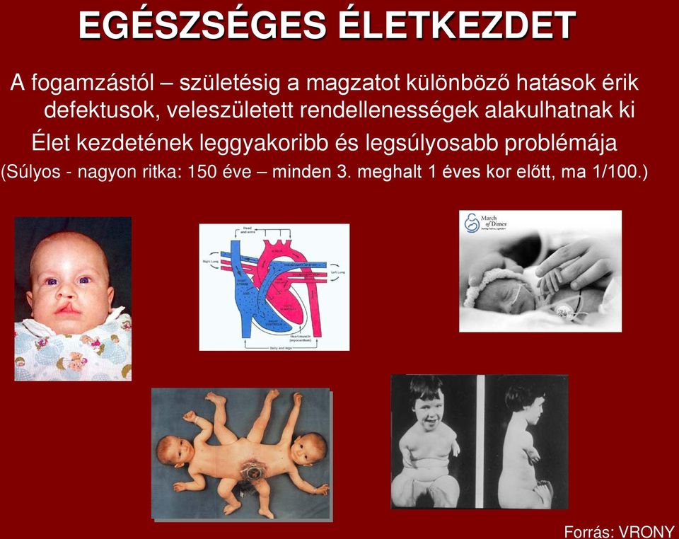 Élet kezdetének leggyakoribb és legsúlyosabb problémája (Súlyos -