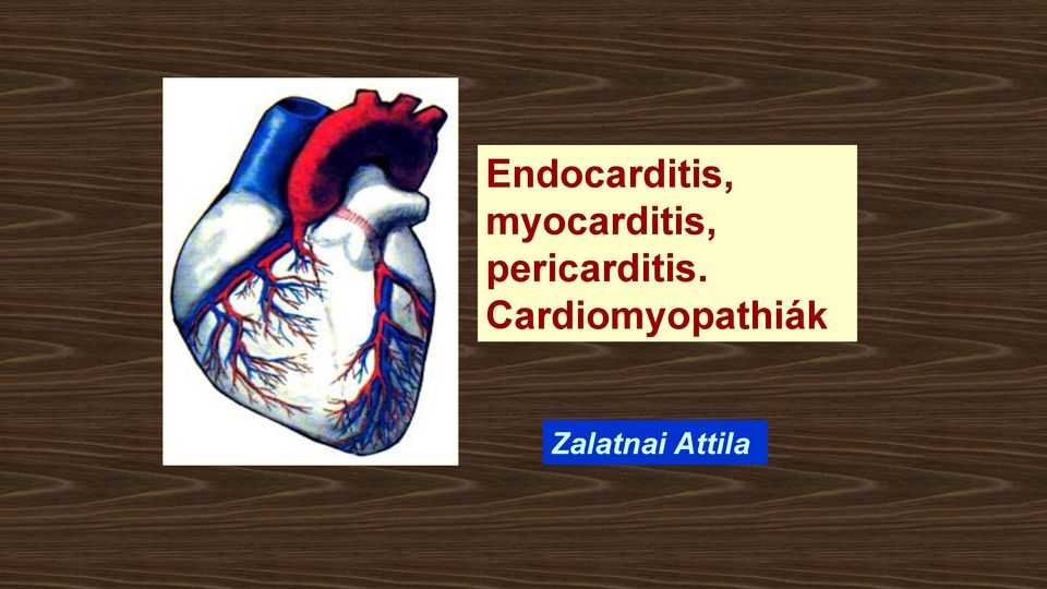 pericarditis.