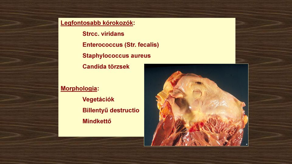 fecalis) Staphylococcus aureus Candida