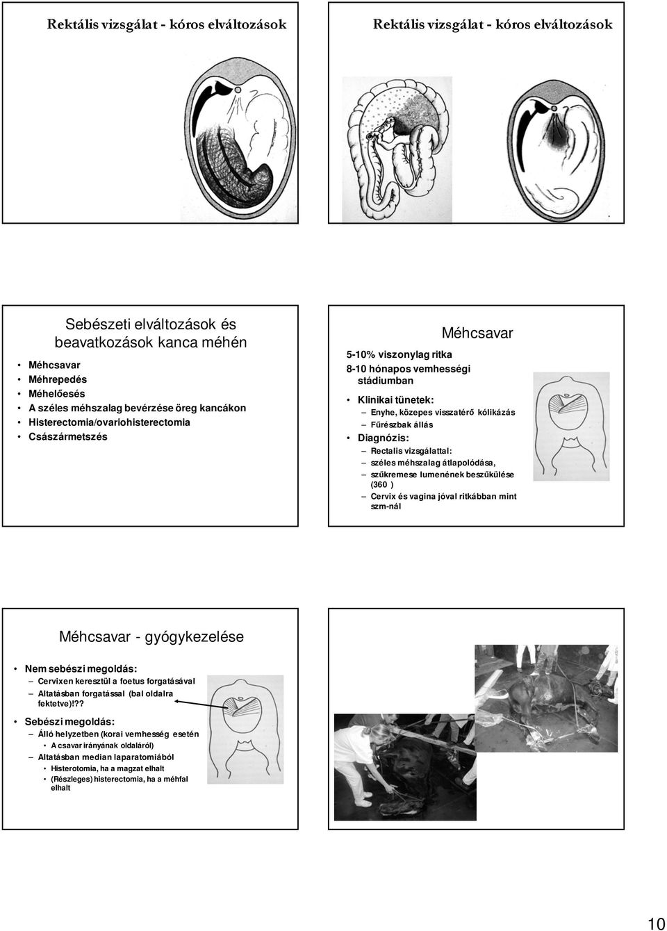 Diagnózis: Rectalis vizsgálattal: széles méhszalag átlapolódása, szűkremese lumenének beszűkülése (360 ) Cervix és vagina jóval ritkábban mint szm-nál Méhcsavar - gyógykezelése Nem sebészi megoldás: