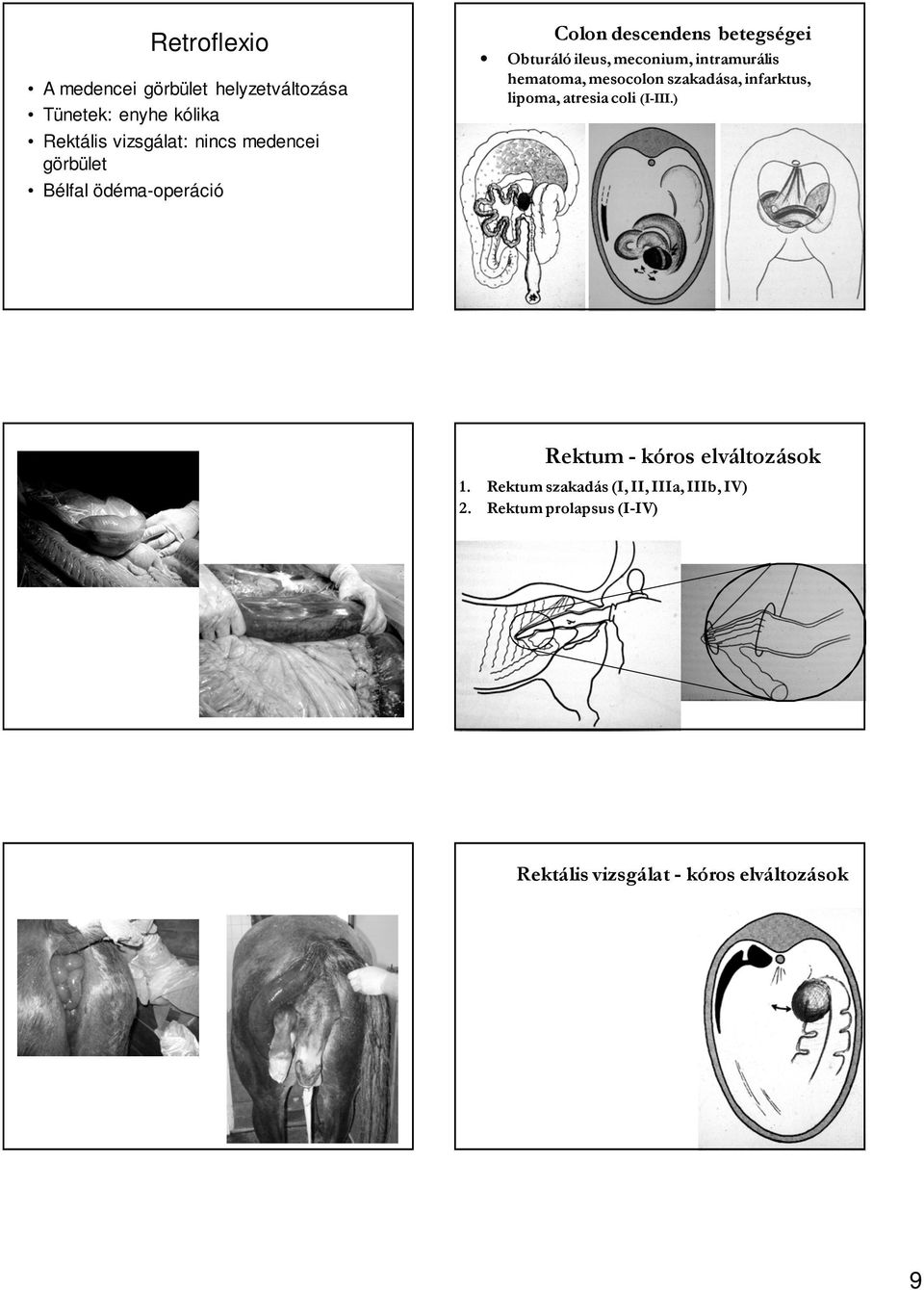 mesocolon szakadása, infarktus, lipoma, atresia coli (I-III.) Bodó Gábor IV.