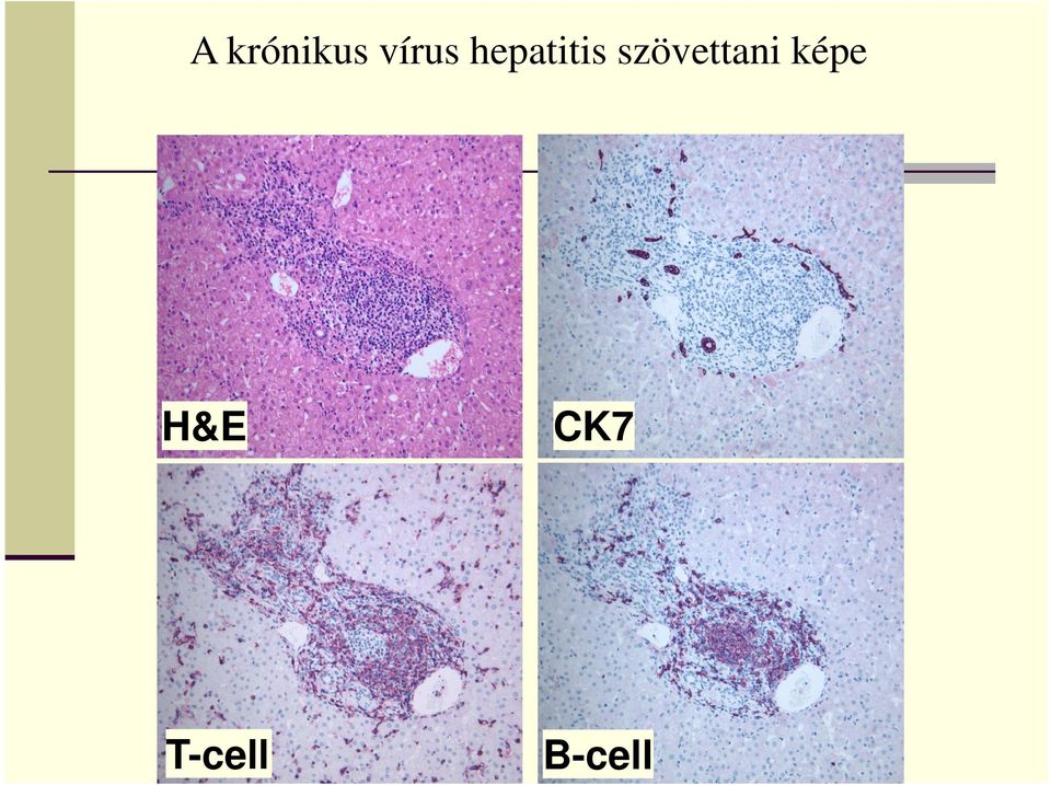 szövettani képe