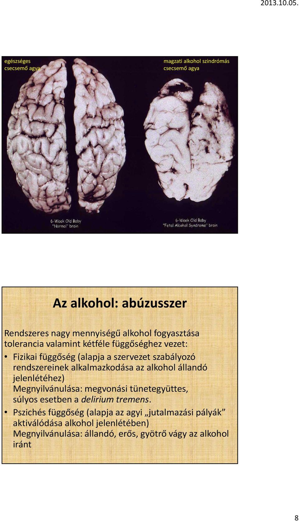 alkalmazkodása az alkohol állandó jelenlétéhez) Megnyilvánulása: megvonási tünetegyüttes, súlyos esetben a delirium tremens.