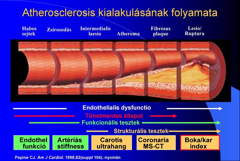 Endothelialis dysfunctio Tünetmentes állapot Funkcionális tesztek Strukturális tesztek