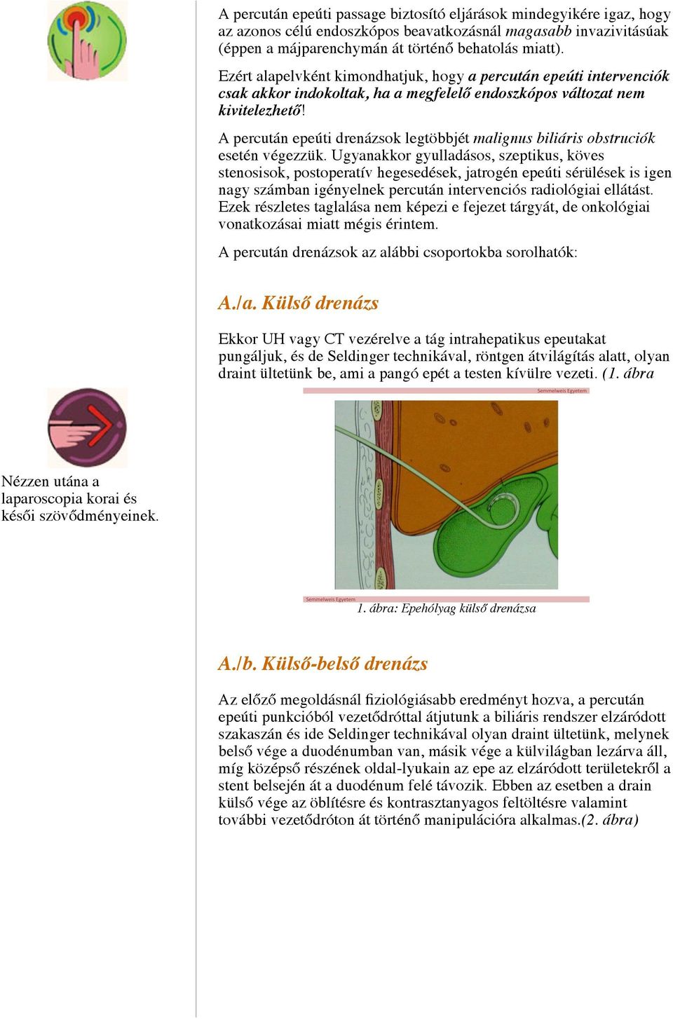 A.) Percután epeúti drainage típusok - PDF Ingyenes letöltés