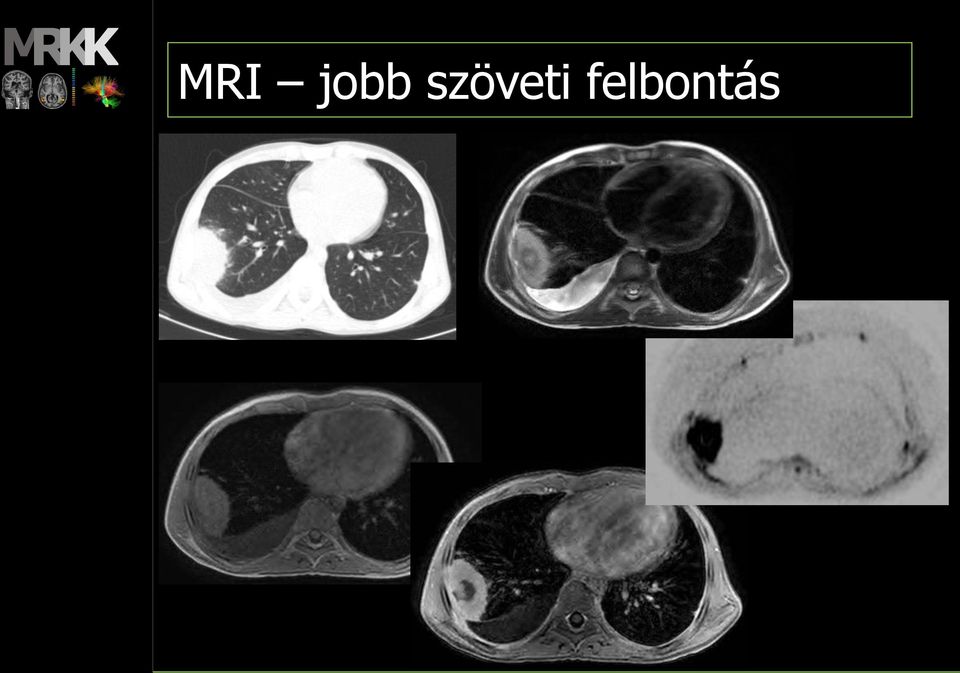 felbontás
