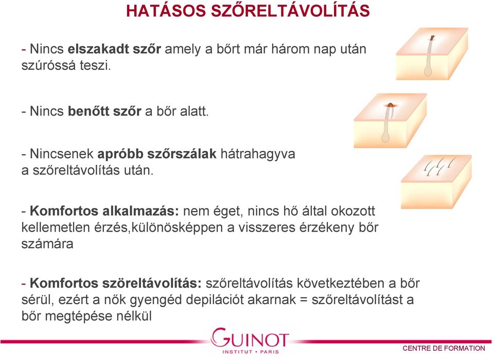 - Komfortos alkalmazás: nem éget, nincs hő által okozott kellemetlen érzés,különösképpen a visszeres érzékeny bőr