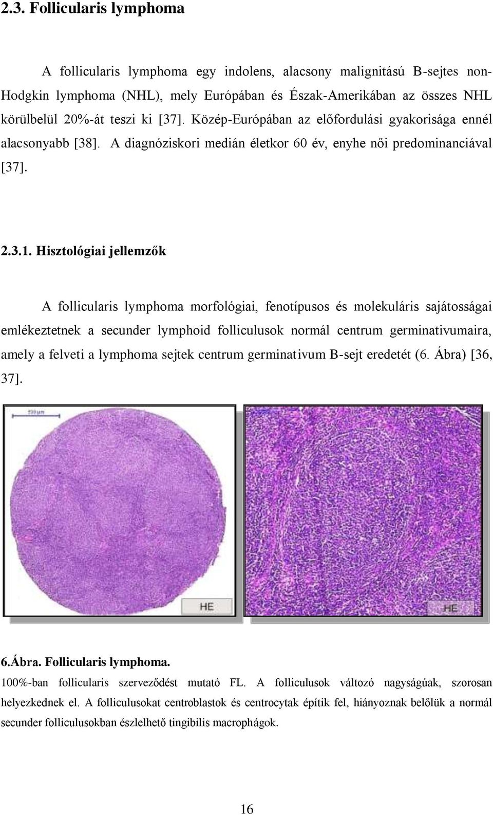 Hisztológiai jellemzők A follicularis lymphoma morfológiai, fenotípusos és molekuláris sajátosságai emlékeztetnek a secunder lymphoid folliculusok normál centrum germinativumaira, amely a felveti a