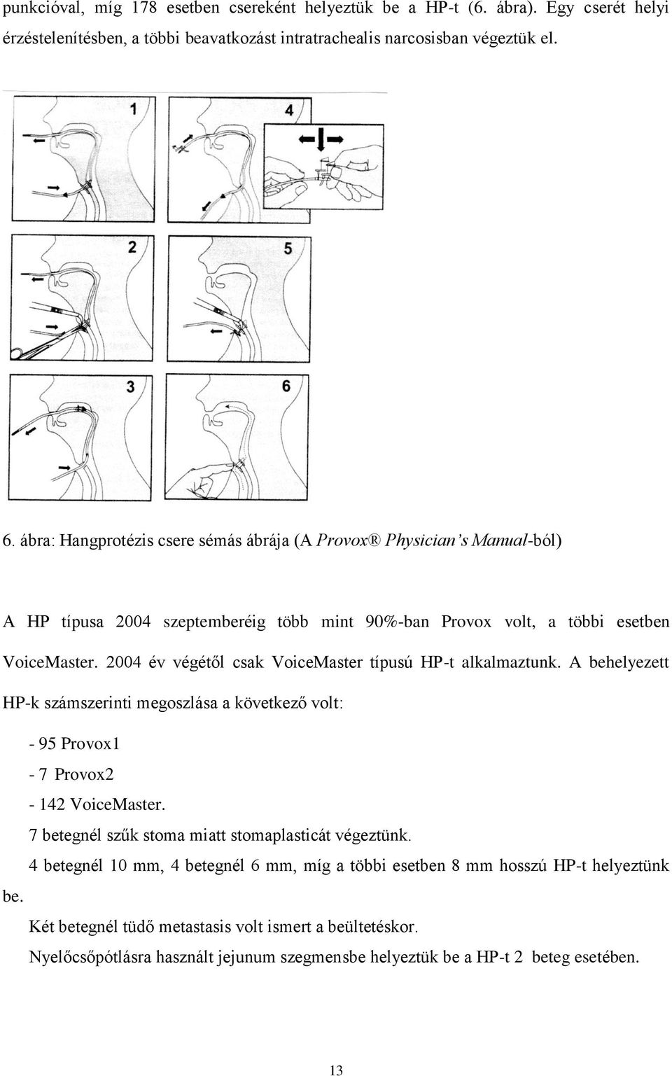 2004 év végétől csak VoiceMaster típusú HP-t alkalmaztunk. A behelyezett HP-k számszerinti megoszlása a következő volt: - 95 Provox1-7 Provox2-142 VoiceMaster.