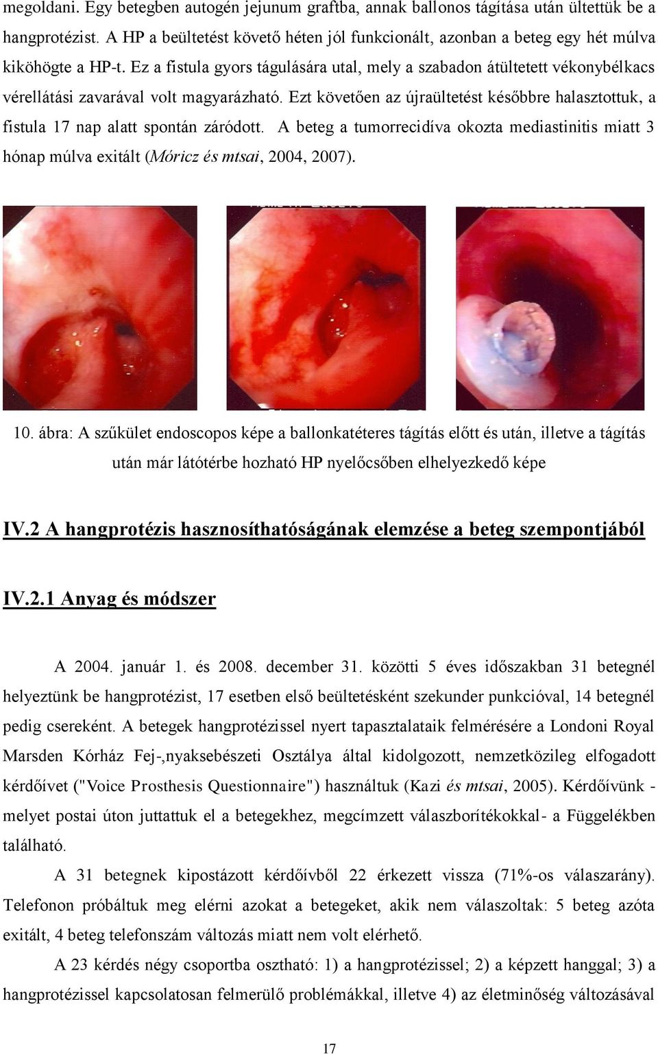 Ez a fistula gyors tágulására utal, mely a szabadon átültetett vékonybélkacs vérellátási zavarával volt magyarázható.