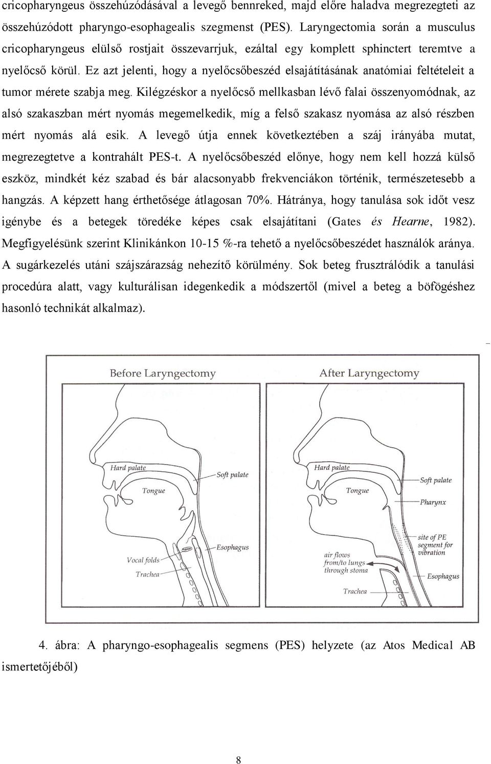 Ez azt jelenti, hogy a nyelőcsőbeszéd elsajátításának anatómiai feltételeit a tumor mérete szabja meg.
