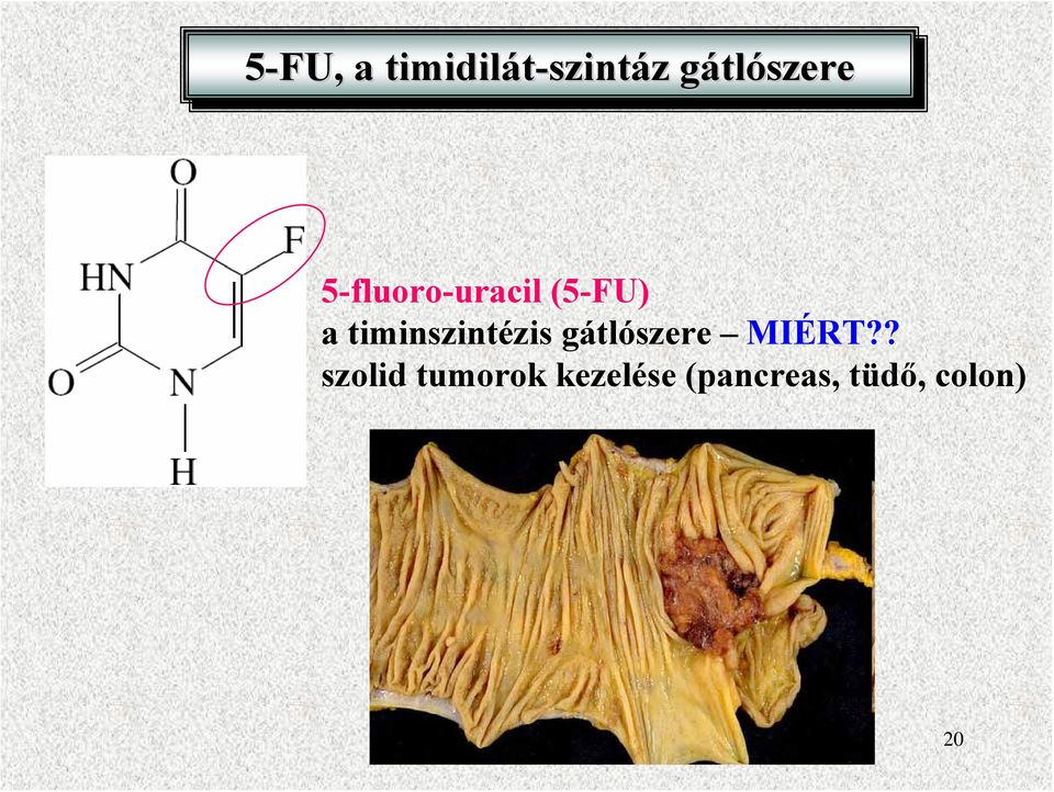 timinszintézis gátlószere MIÉRT?