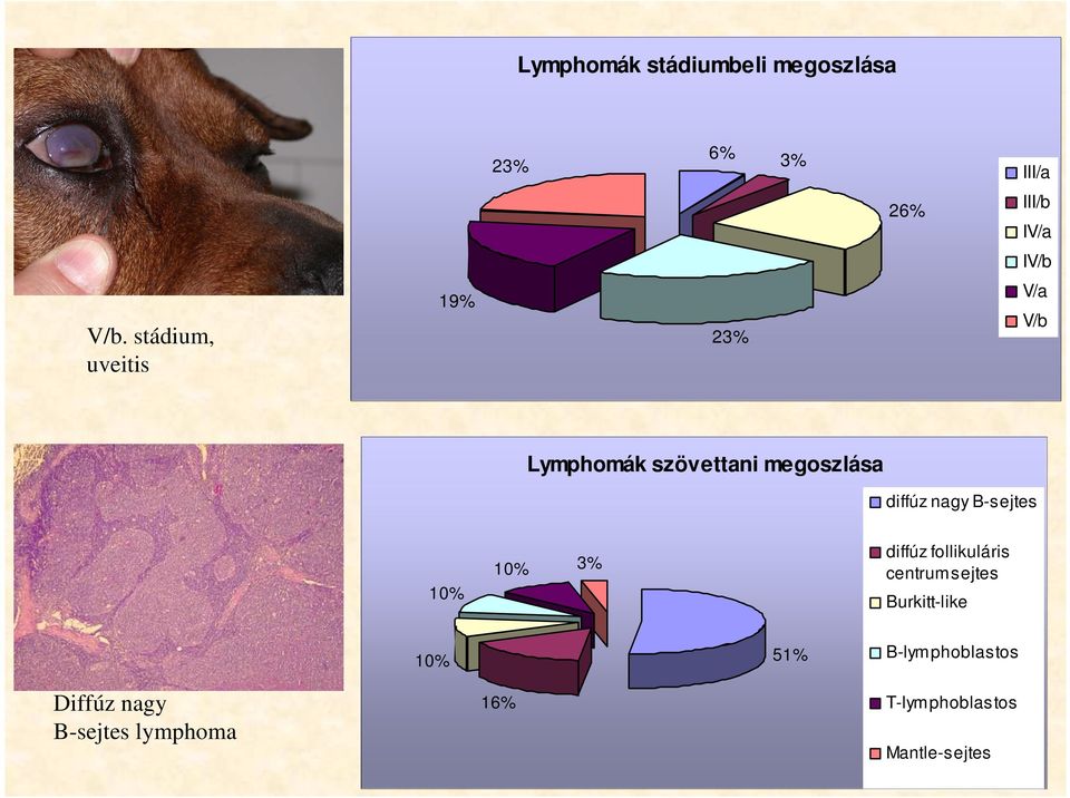 B-sejtes 10% 10% 3% diffúz follikuláris centrumsejtes Burkitt-like 10% 51%