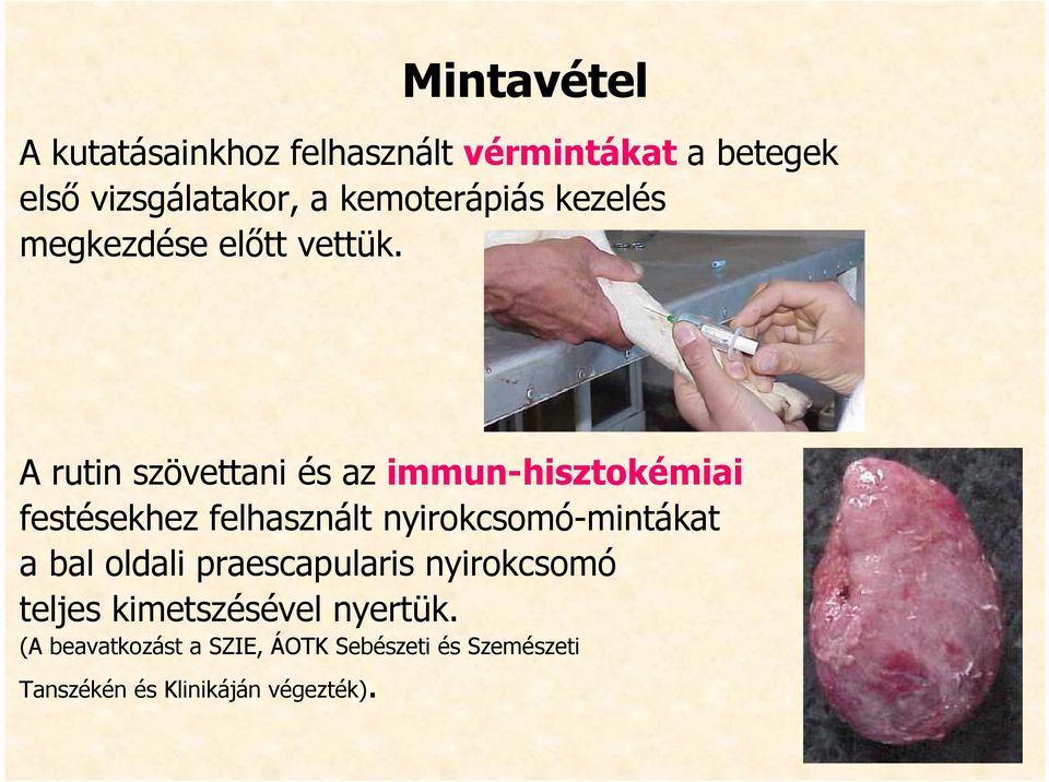 A rutin szövettani és az immun-hisztokémiai festésekhez felhasznált nyirokcsomó-mintákat a