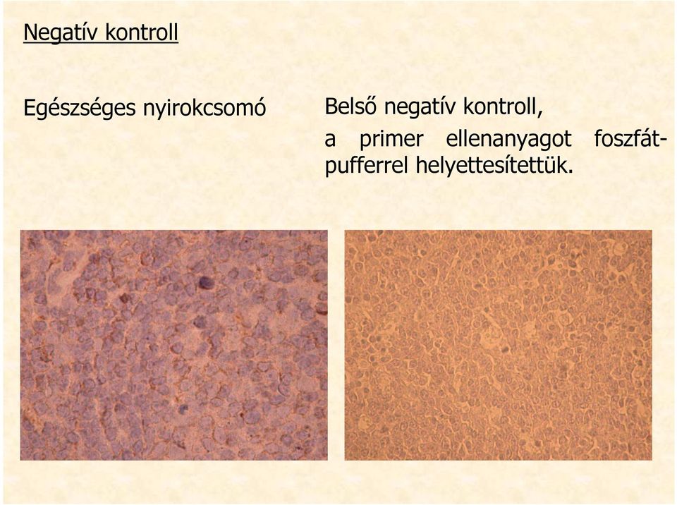 kontroll, a primer