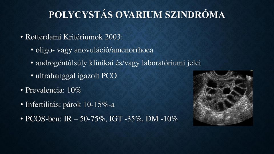 és/vagy laboratóriumi jelei ultrahanggal igazolt PCO