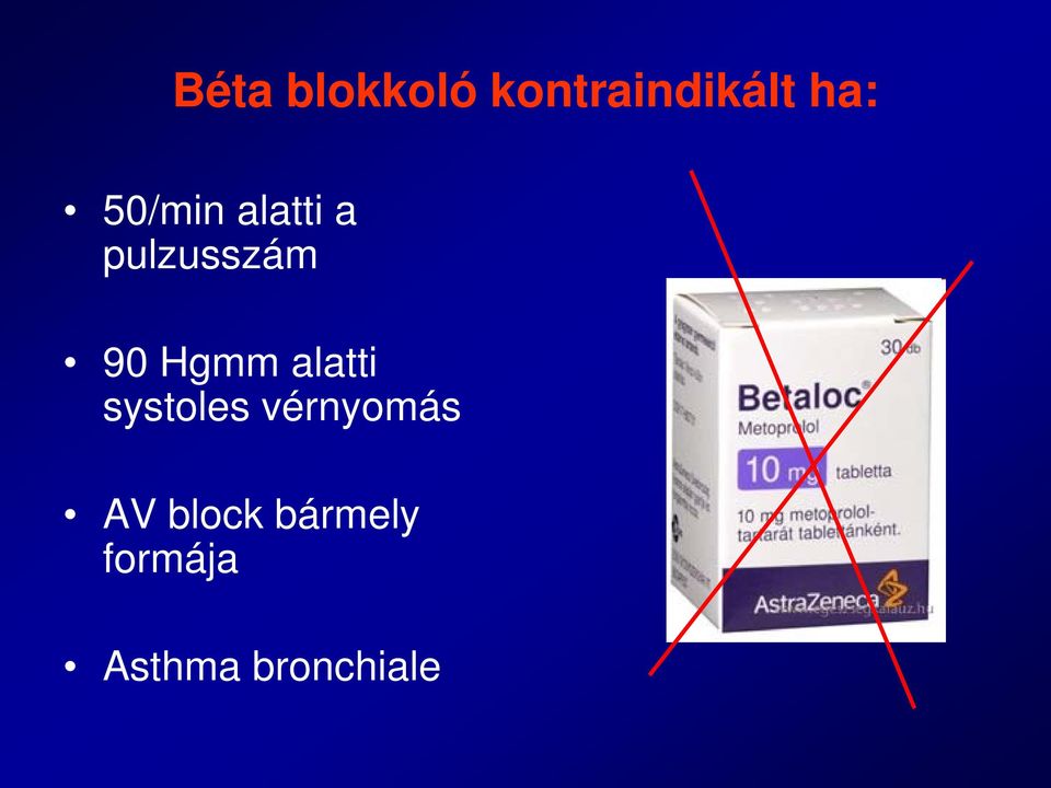 Hgmm alatti systoles vérnyomás AV