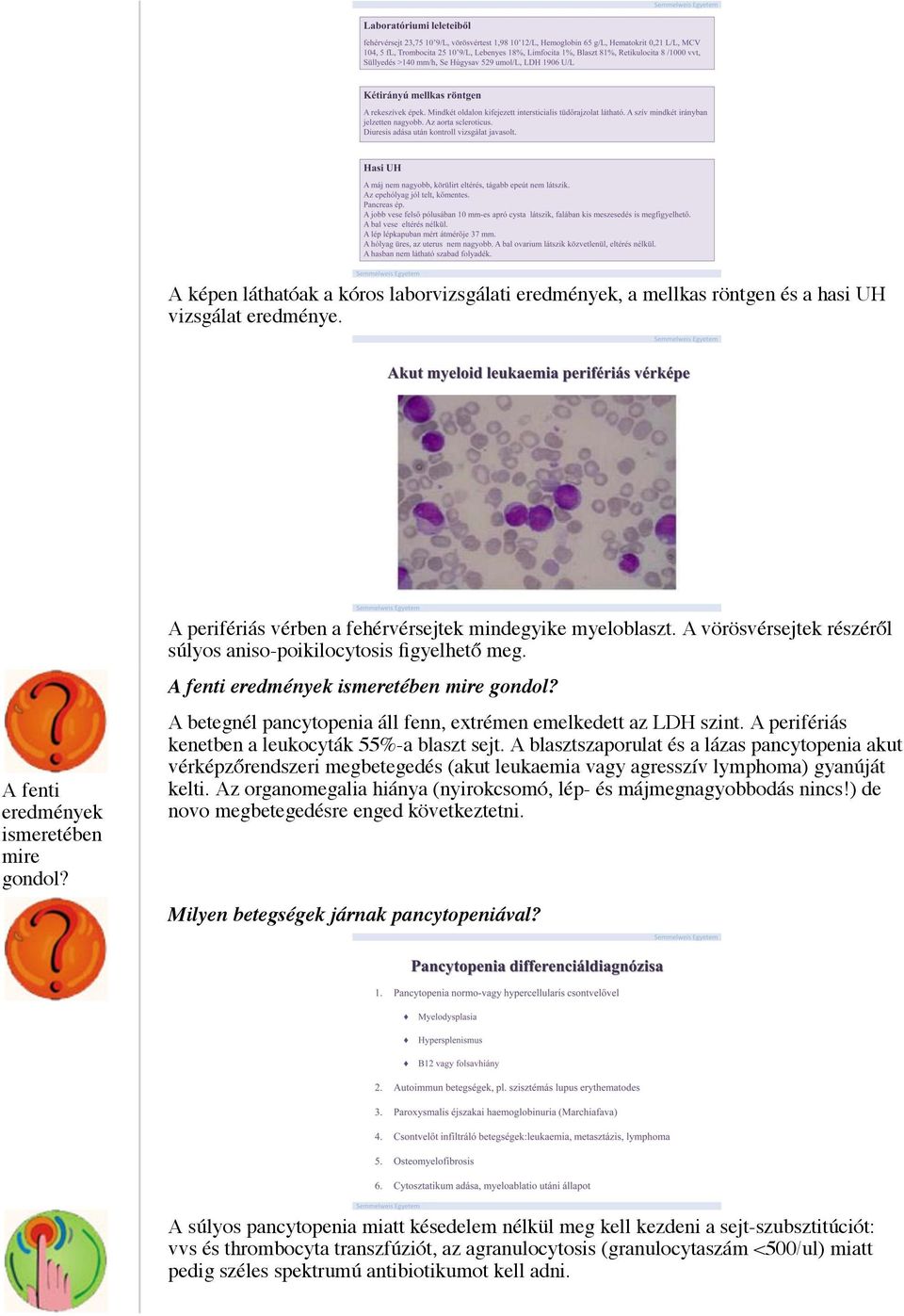 A betegnél pancytopenia áll fenn, extrémen emelkedett az LDH szint. A perifériás kenetben a leukocyták 55%-a blaszt sejt.