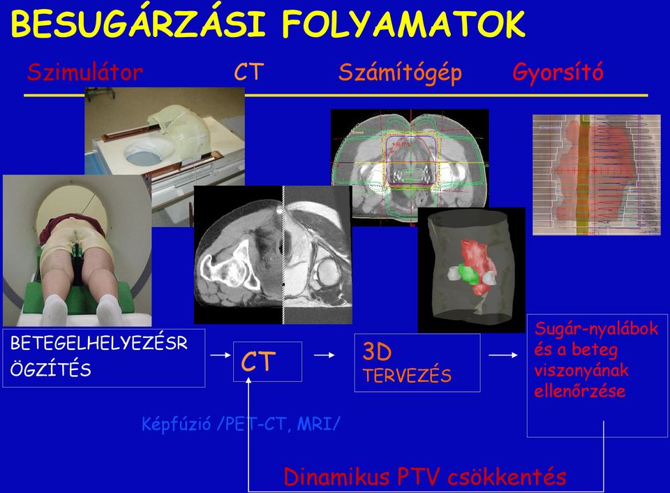 Sugár-nyalábok és a beteg viszonyának