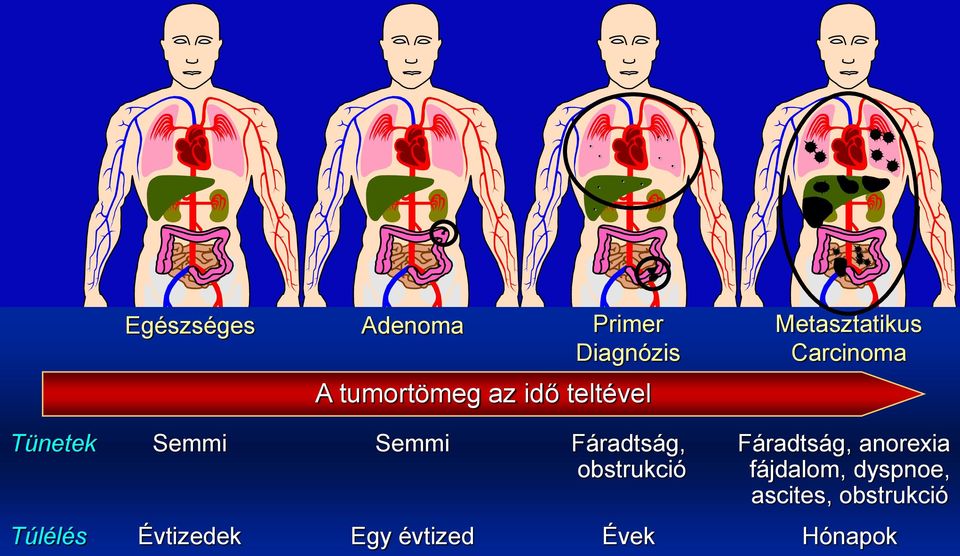 obstrukció fájdalom, dyspnoe, ascites, obstrukció Túlélés Dr.